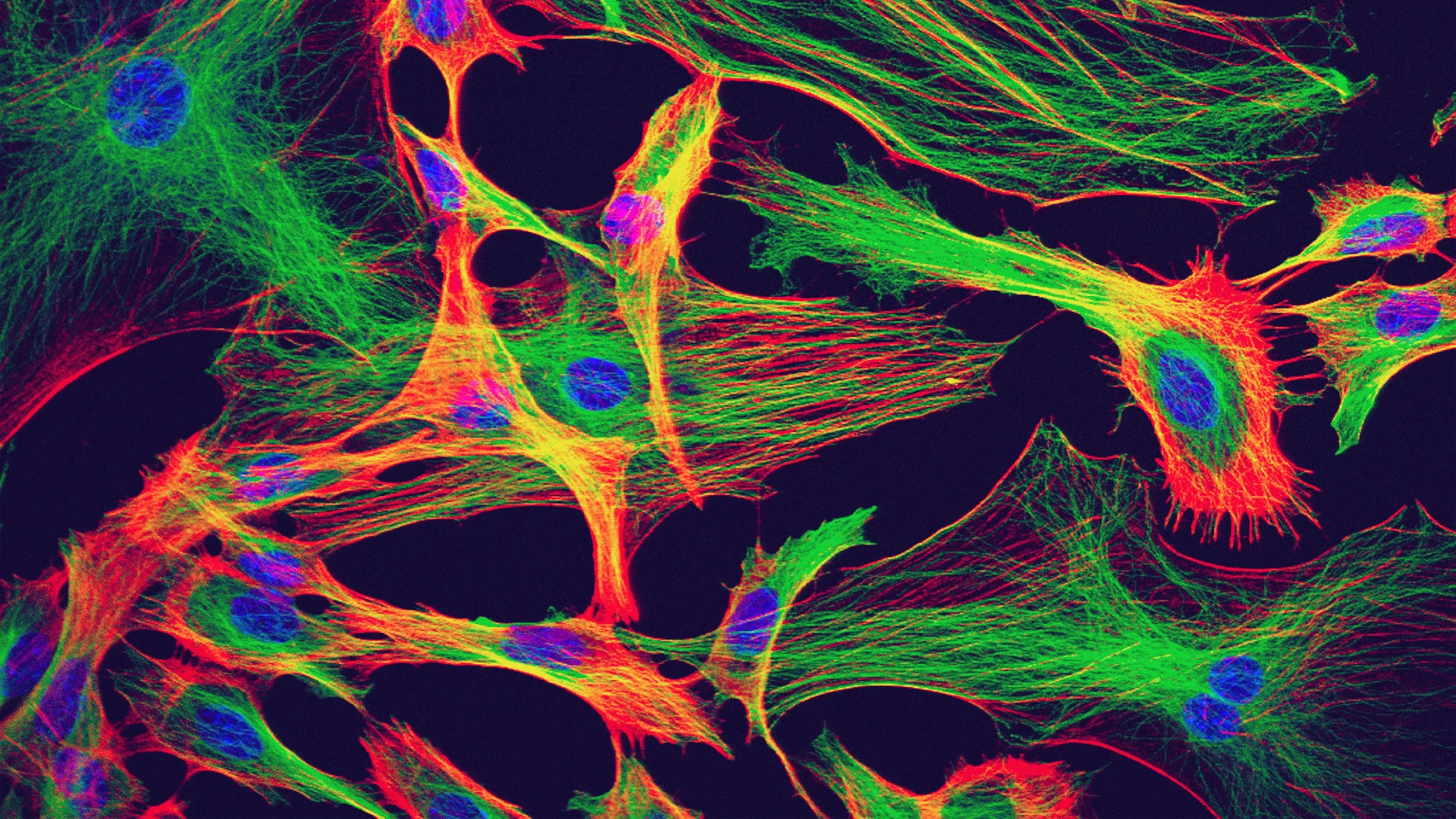 Astrocytes from the brain of a mouse are stained in neon colors that emphasize their stretched, starlike shape.